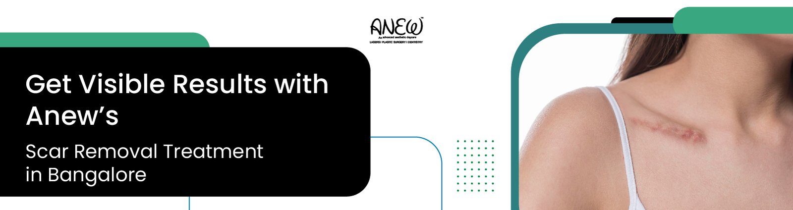 scar removal treatment in bangalore​